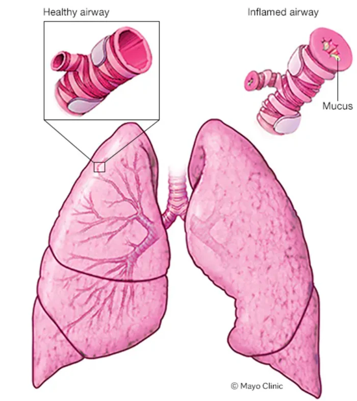 Guia completa per al control diari i l’atenció urgent dels pacients amb asma
