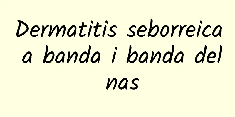 Dermatitis seborreica a banda i banda del nas