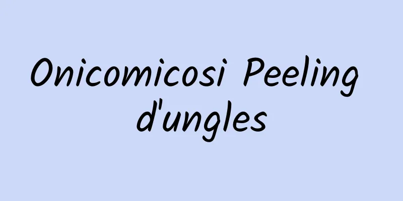 Onicomicosi Peeling d'ungles