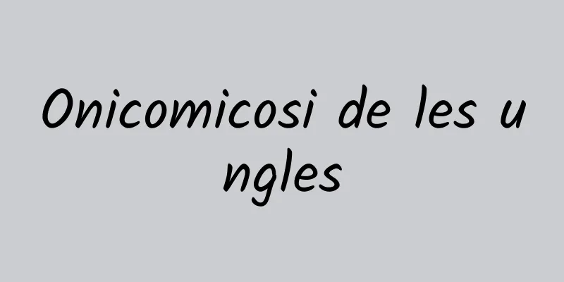 Onicomicosi de les ungles