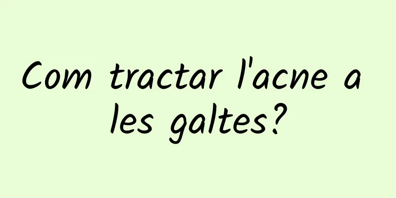 Com tractar l'acne a les galtes?