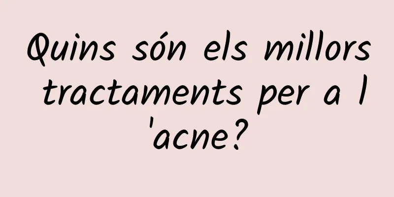 Quins són els millors tractaments per a l'acne?