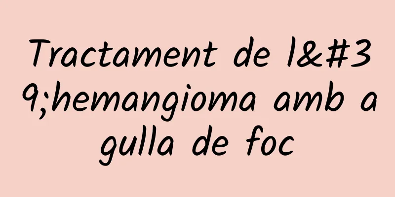 Tractament de l'hemangioma amb agulla de foc