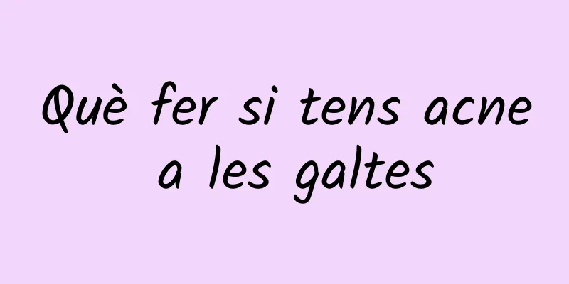 Què fer si tens acne a les galtes