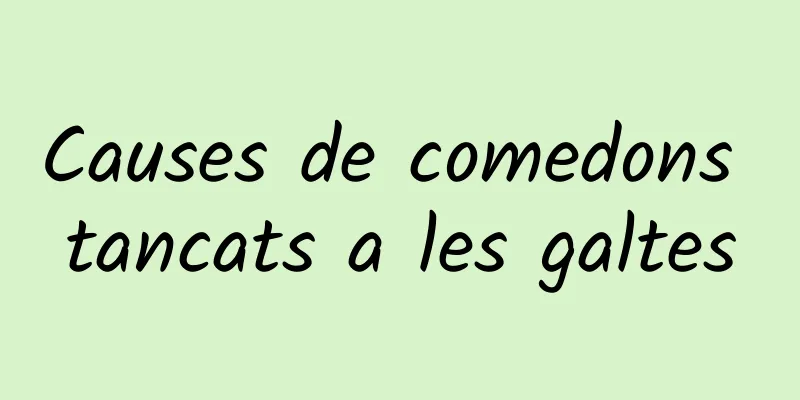 Causes de comedons tancats a les galtes