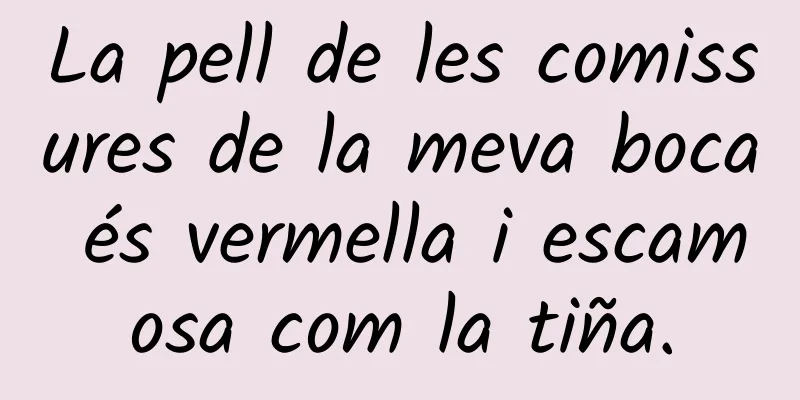 La pell de les comissures de la meva boca és vermella i escamosa com la tiña.