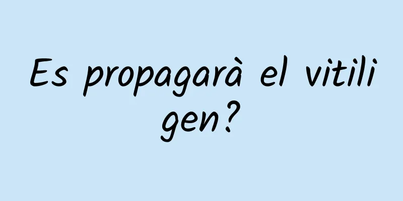 Es propagarà el vitiligen?