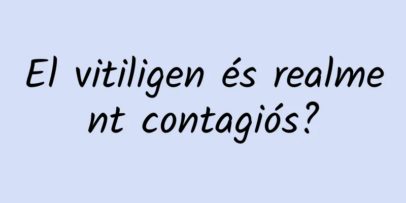 El vitiligen és realment contagiós?