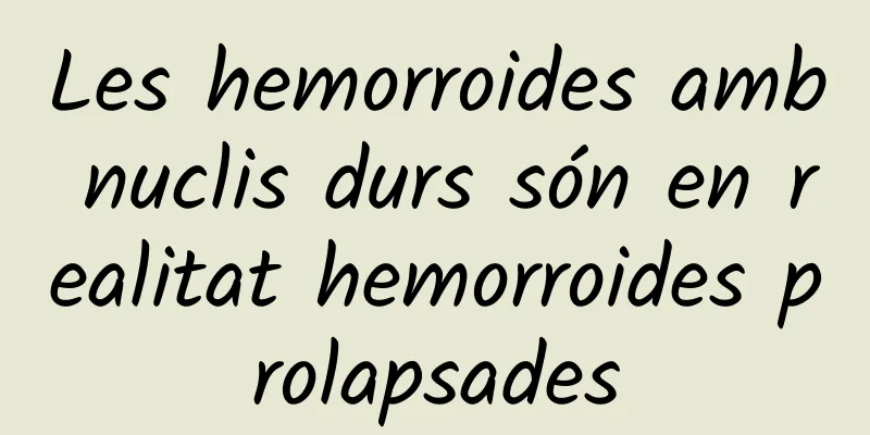 Les hemorroides amb nuclis durs són en realitat hemorroides prolapsades