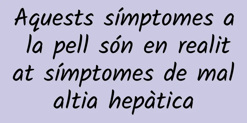 Aquests símptomes a la pell són en realitat símptomes de malaltia hepàtica