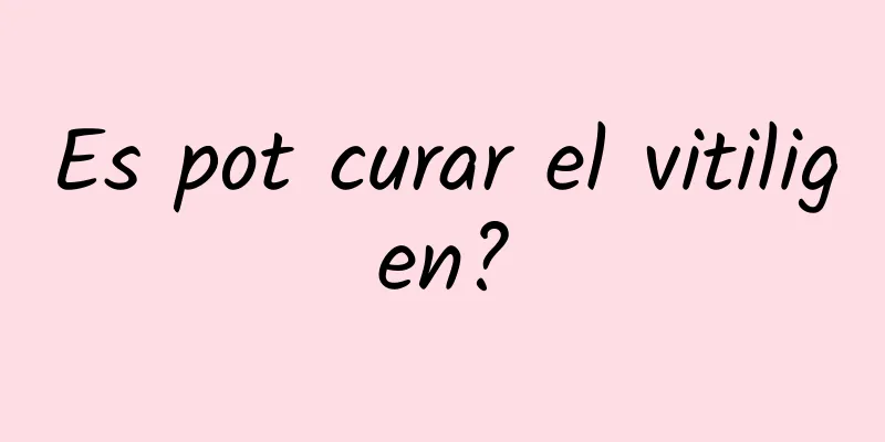 Es pot curar el vitiligen?