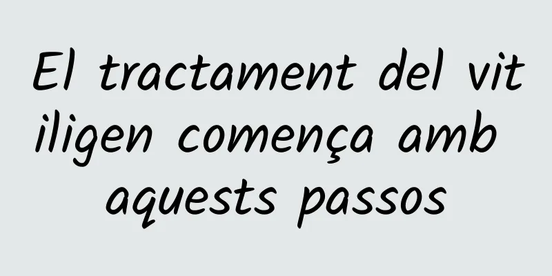 El tractament del vitiligen comença amb aquests passos