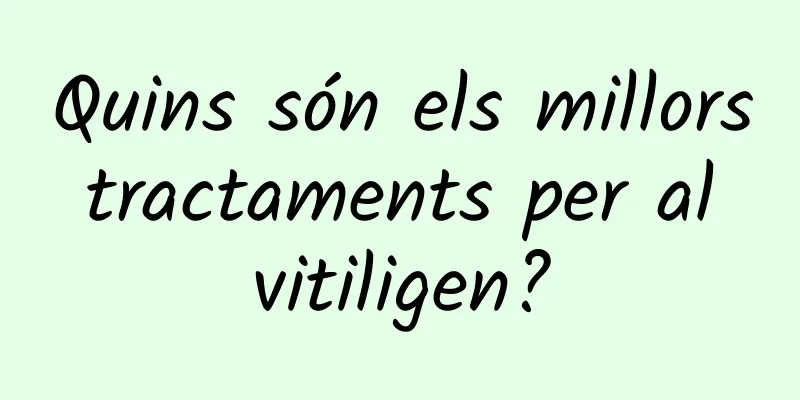 Quins són els millors tractaments per al vitiligen?
