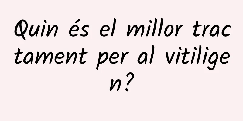 Quin és el millor tractament per al vitiligen?