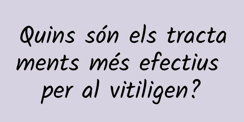 Quins són els tractaments més efectius per al vitiligen?