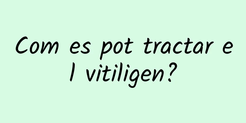 Com es pot tractar el vitiligen?