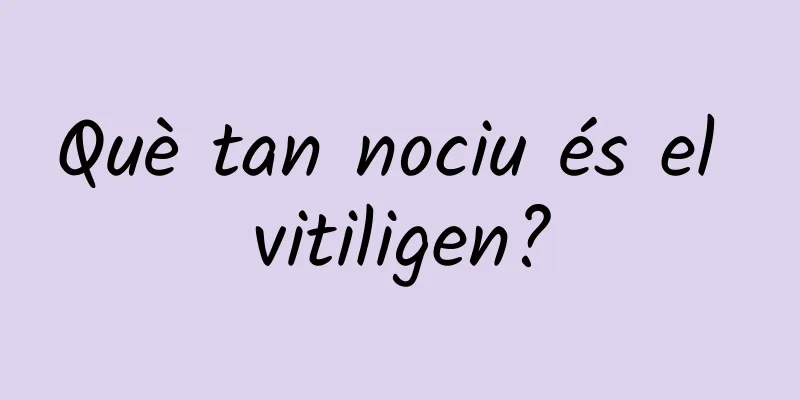 Què tan nociu és el vitiligen?