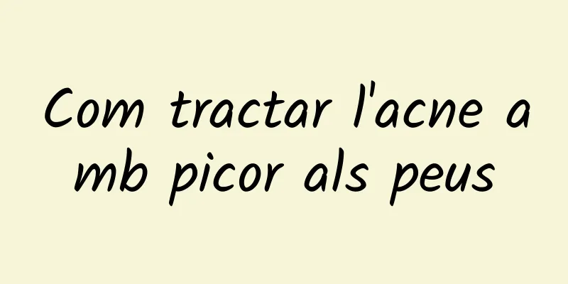 Com tractar l'acne amb picor als peus