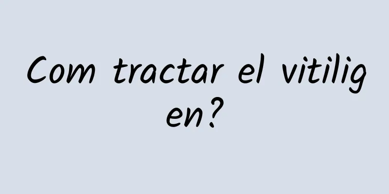 Com tractar el vitiligen?