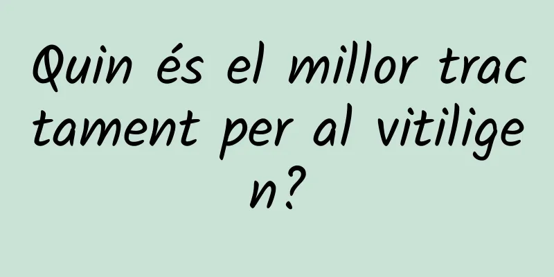 Quin és el millor tractament per al vitiligen?