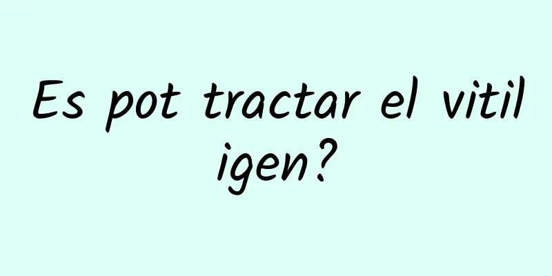 Es pot tractar el vitiligen?