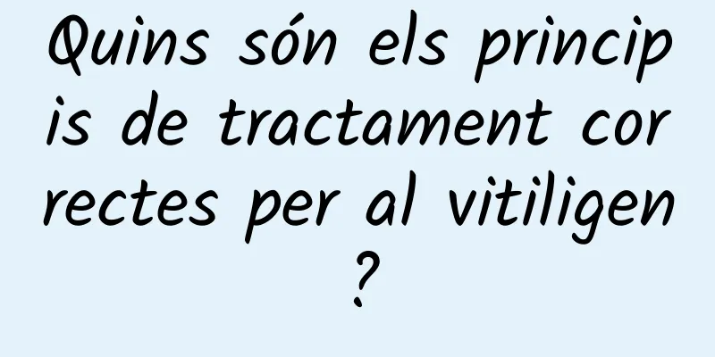 Quins són els principis de tractament correctes per al vitiligen?