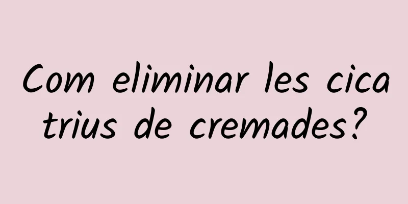 Com eliminar les cicatrius de cremades?