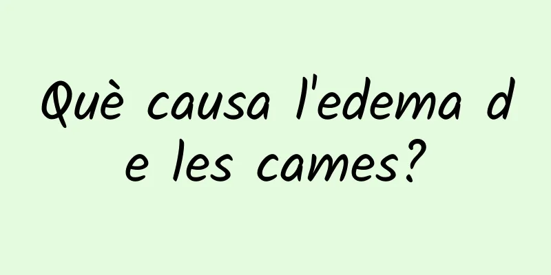 Què causa l'edema de les cames?