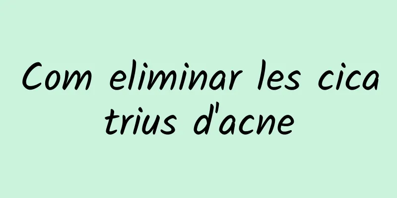 Com eliminar les cicatrius d'acne