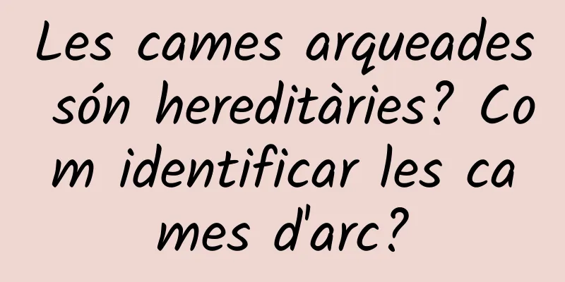 Les cames arqueades són hereditàries? Com identificar les cames d'arc?