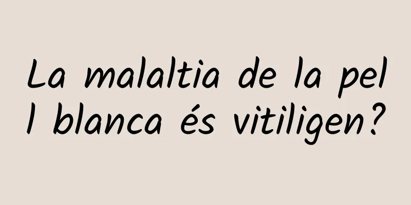 La malaltia de la pell blanca és vitiligen?