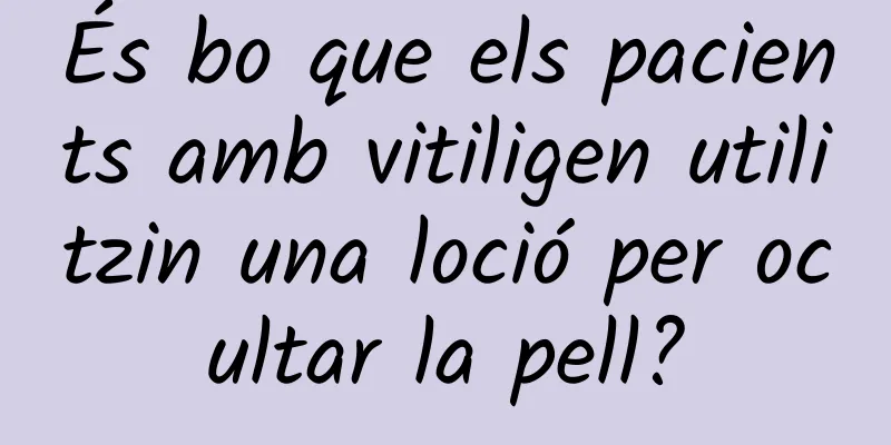 És bo que els pacients amb vitiligen utilitzin una loció per ocultar la pell?