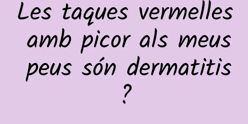 Les taques vermelles amb picor als meus peus són dermatitis?