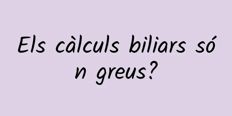 Els càlculs biliars són greus?