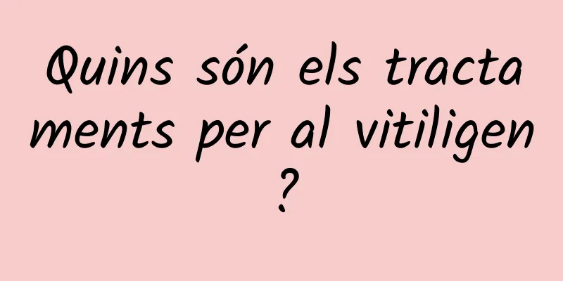 Quins són els tractaments per al vitiligen?