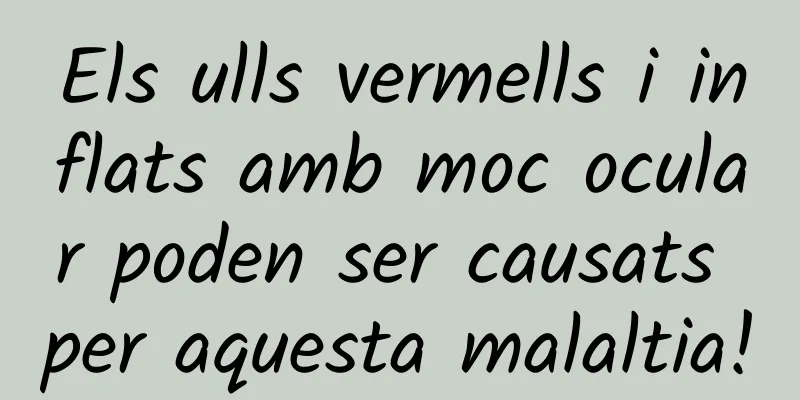 Els ulls vermells i inflats amb moc ocular poden ser causats per aquesta malaltia!