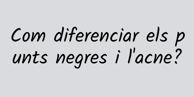 Com diferenciar els punts negres i l'acne?