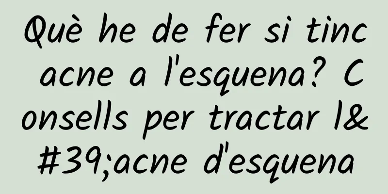 Què he de fer si tinc acne a l'esquena? Consells per tractar l'acne d'esquena