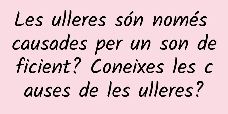 Les ulleres són només causades per un son deficient? Coneixes les causes de les ulleres?