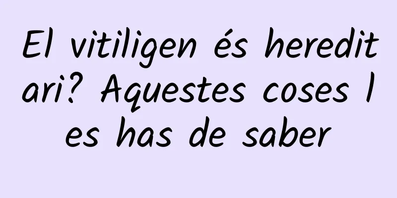 El vitiligen és hereditari? Aquestes coses les has de saber