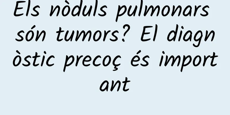 Els nòduls pulmonars són tumors? El diagnòstic precoç és important