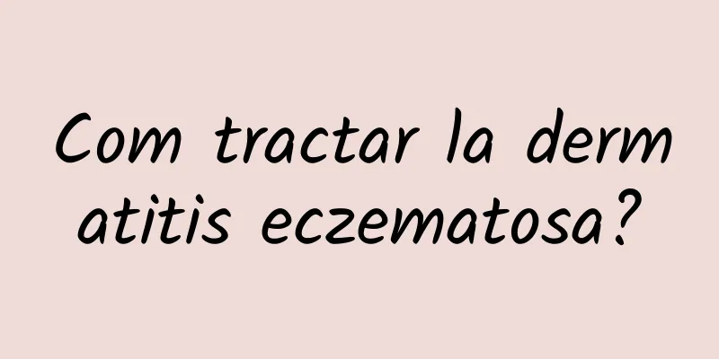 Com tractar la dermatitis eczematosa?