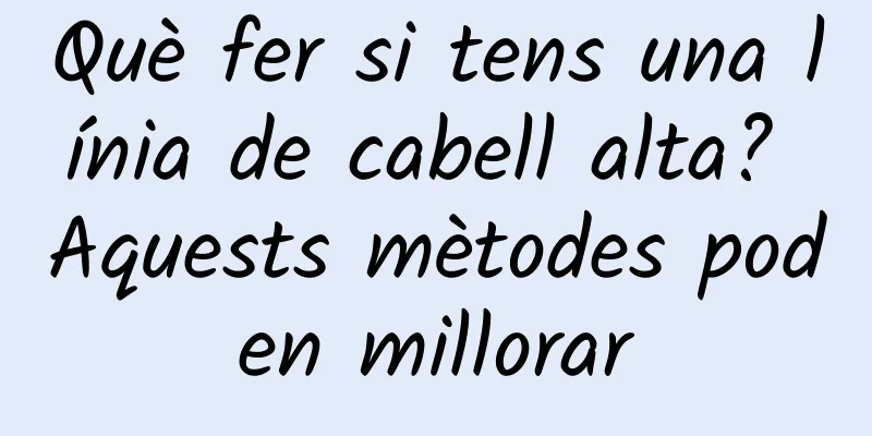 Què fer si tens una línia de cabell alta? Aquests mètodes poden millorar