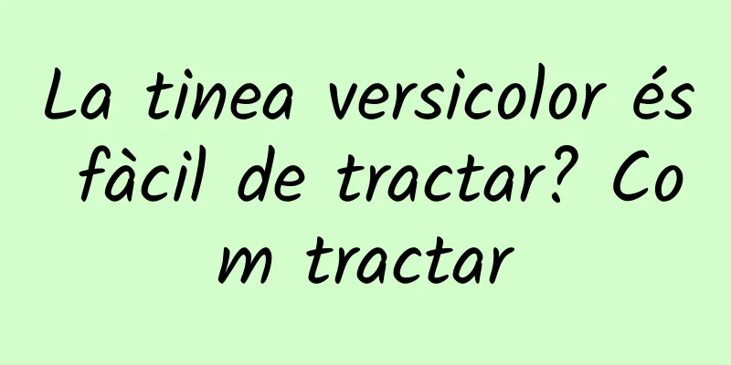 La tinea versicolor és fàcil de tractar? Com tractar