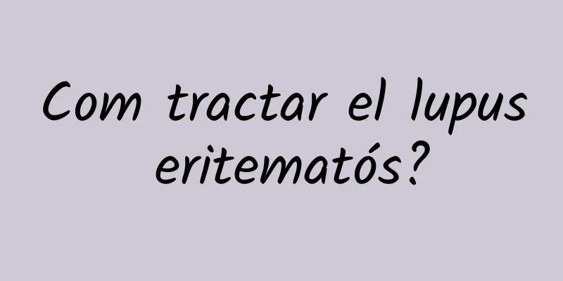 Com tractar el lupus eritematós?
