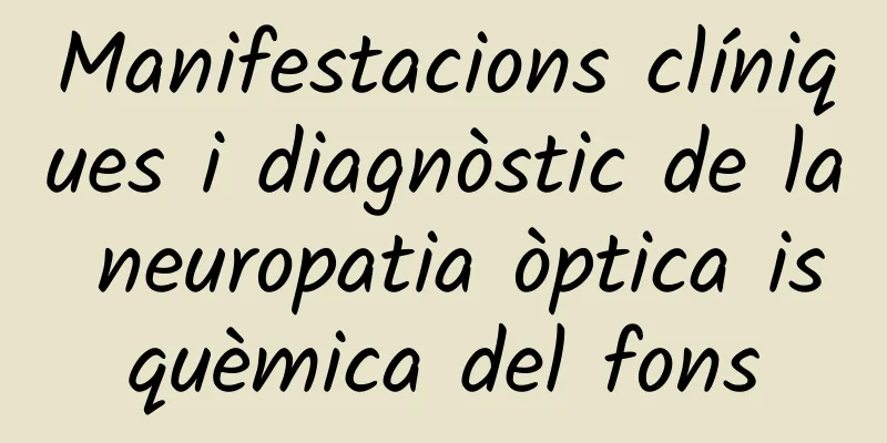 Manifestacions clíniques i diagnòstic de la neuropatia òptica isquèmica del fons