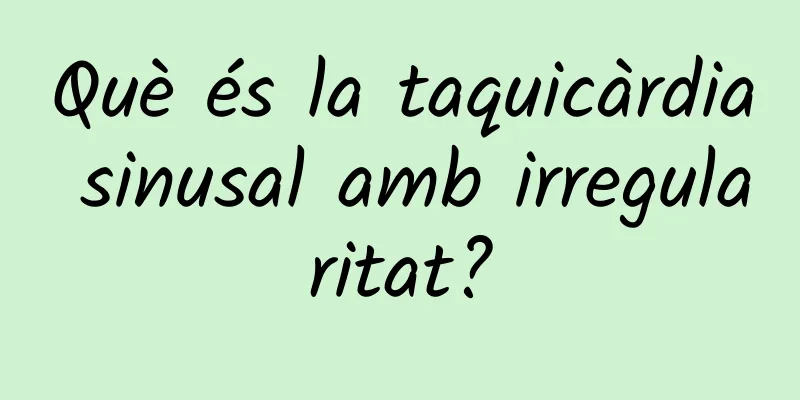 Què és la taquicàrdia sinusal amb irregularitat?