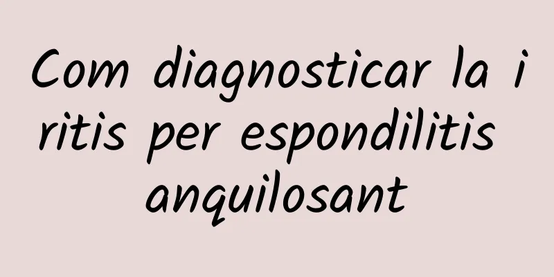 Com diagnosticar la iritis per espondilitis anquilosant