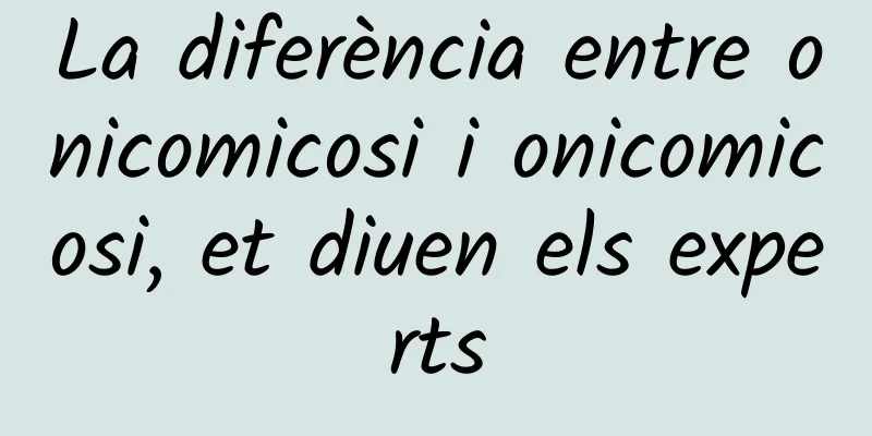 La diferència entre onicomicosi i onicomicosi, et diuen els experts