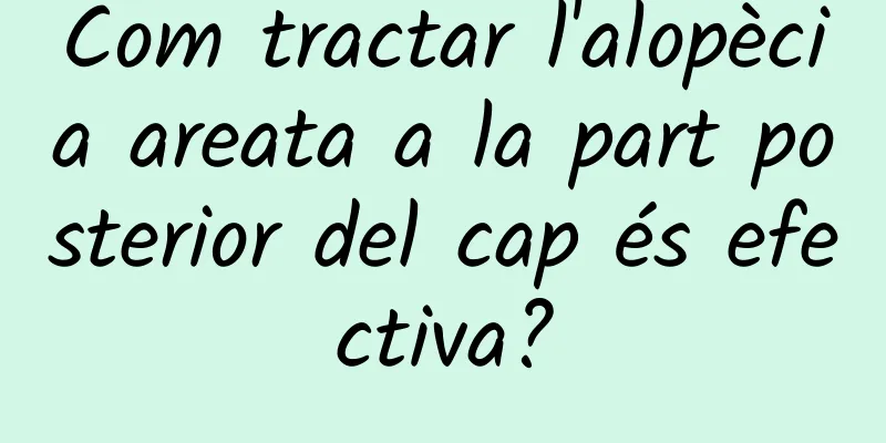 Com tractar l'alopècia areata a la part posterior del cap és efectiva?